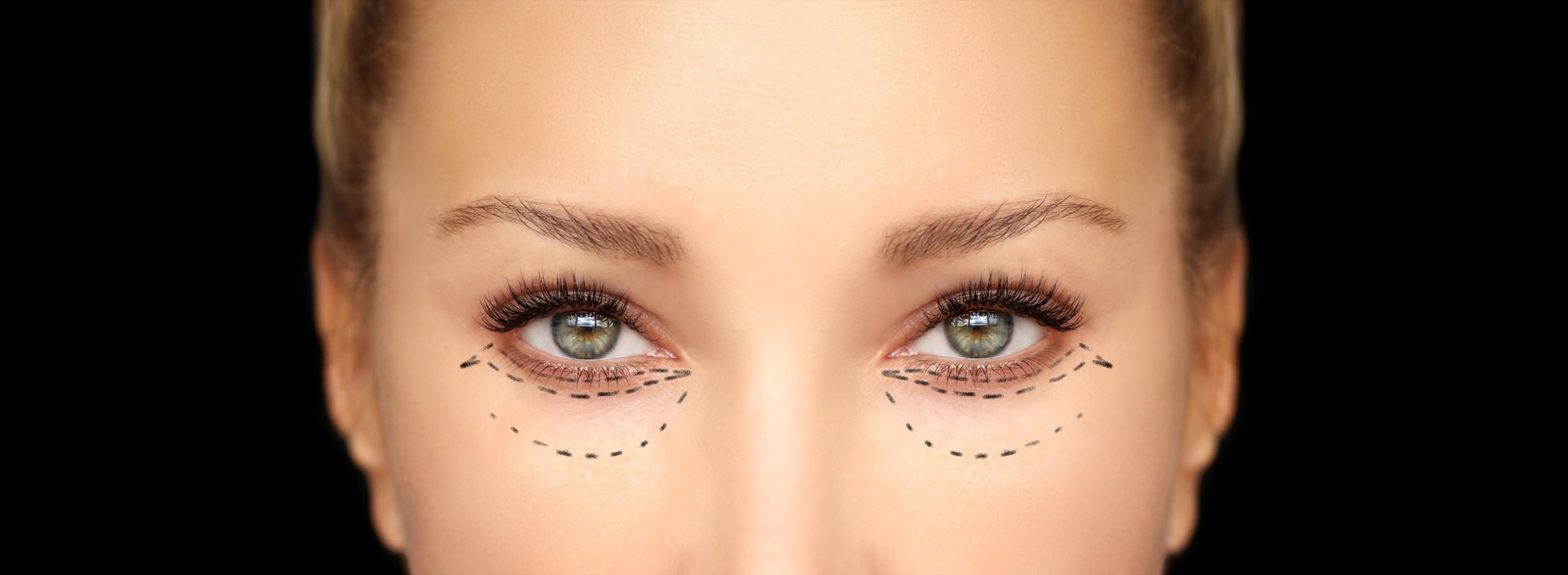 Lower and upper  Blepharoplasty.Marking the face.Perforation lines on females face, plastic surgery concept.