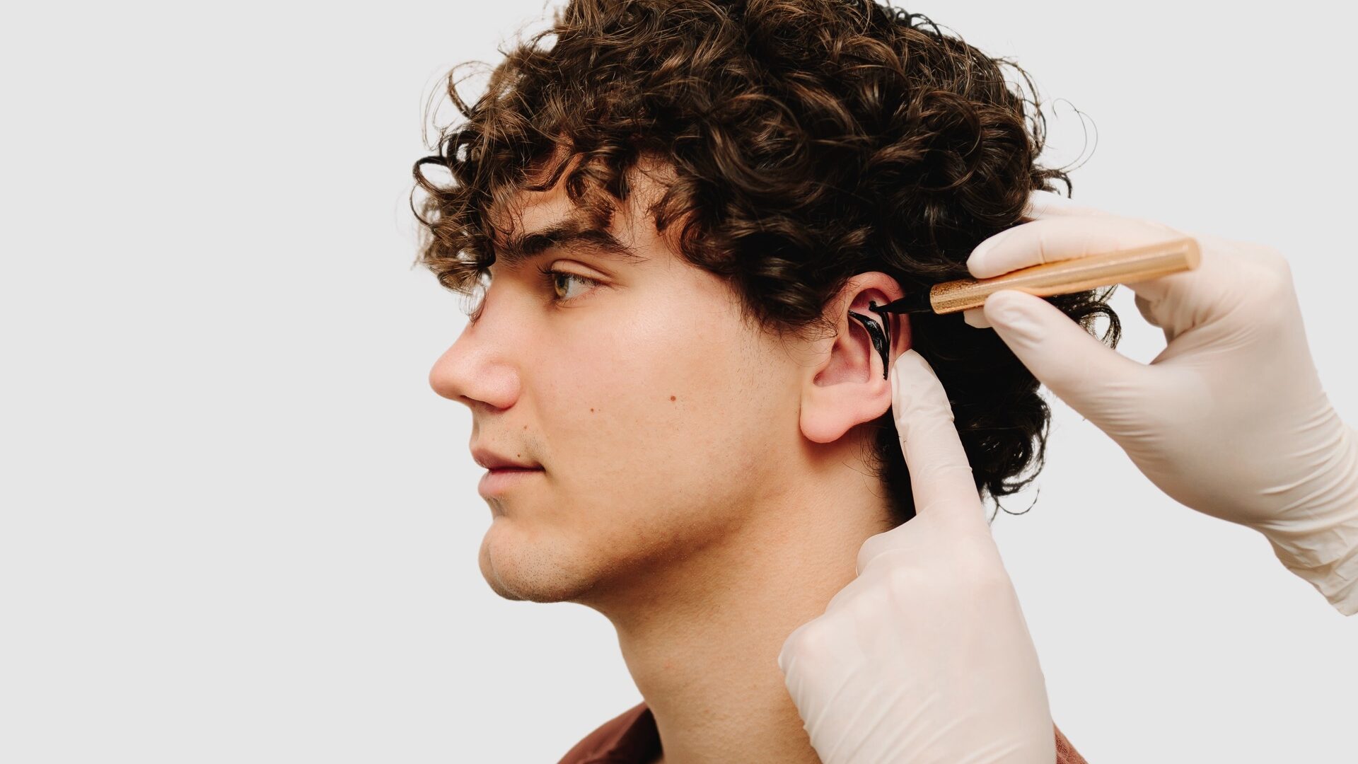 Otoplasty markup making on ear. Surgeon drawing markup lines before Otoplasty surgeon on ears. Applying markup on ear pinna to correct the shape of ears